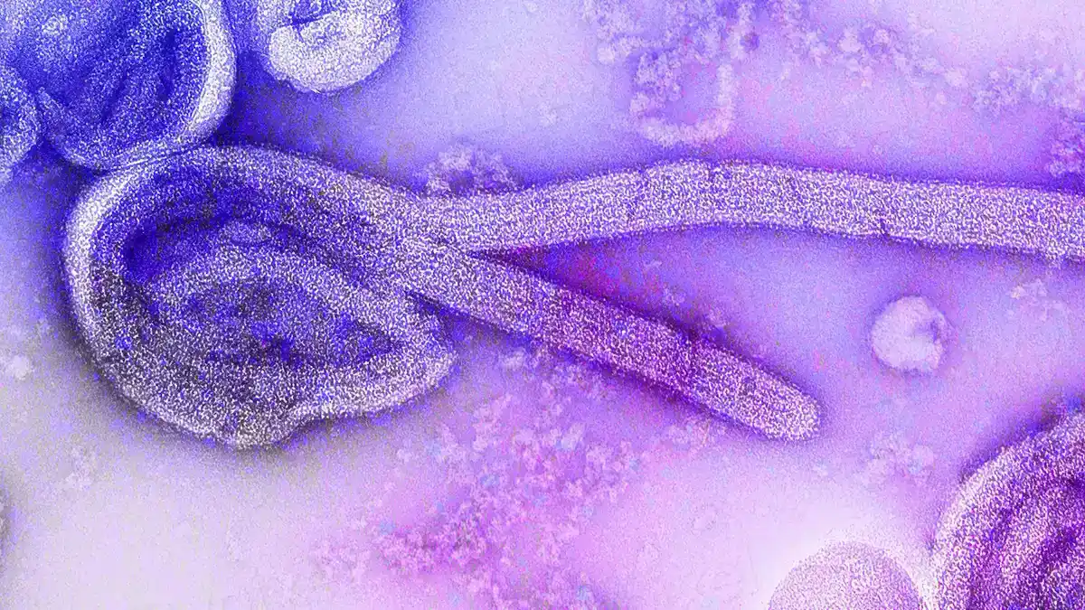 Electron microscope image of Ebola virus particles