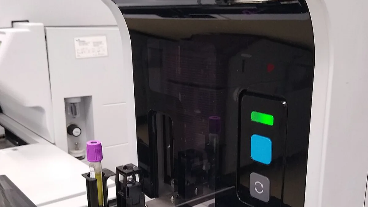 An automated clinical laboratory analyzer with a purple-capped specimen tube loaded on its sample track